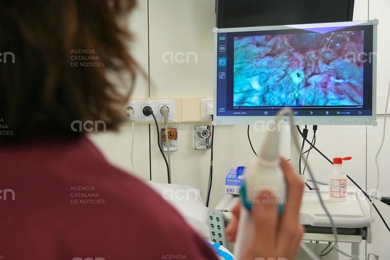 L'Hospital Joan XXIII de Tarragona inicia un tractament amb làser per a tumors vesicals que evita passar per quiròfan