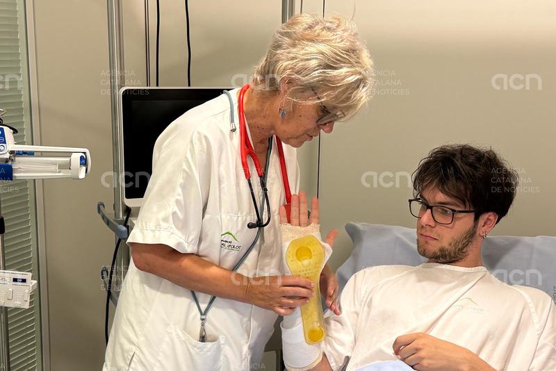 Tres hospitals gironins proven amb èxit fèrules impreses amb 3D per a fractures de canell que poden substituir el guix